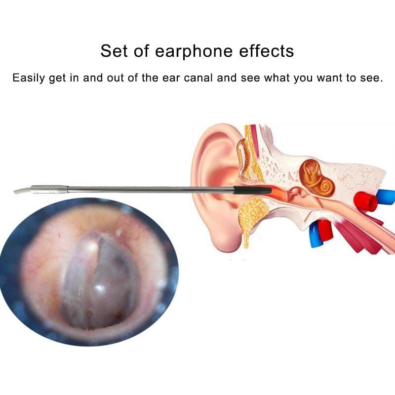 0.3 Million USB Digital Microscope with 6 LEDs, Lens Diameter: 4.9mm - UNIQKART