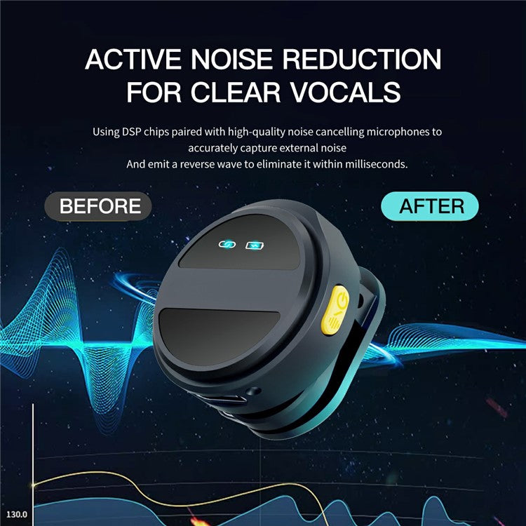 SX21 Type-C 2.4G Wireless Smart Clip-On Microphone (1 Receiver+2 Microphones+1 Charging Bin)