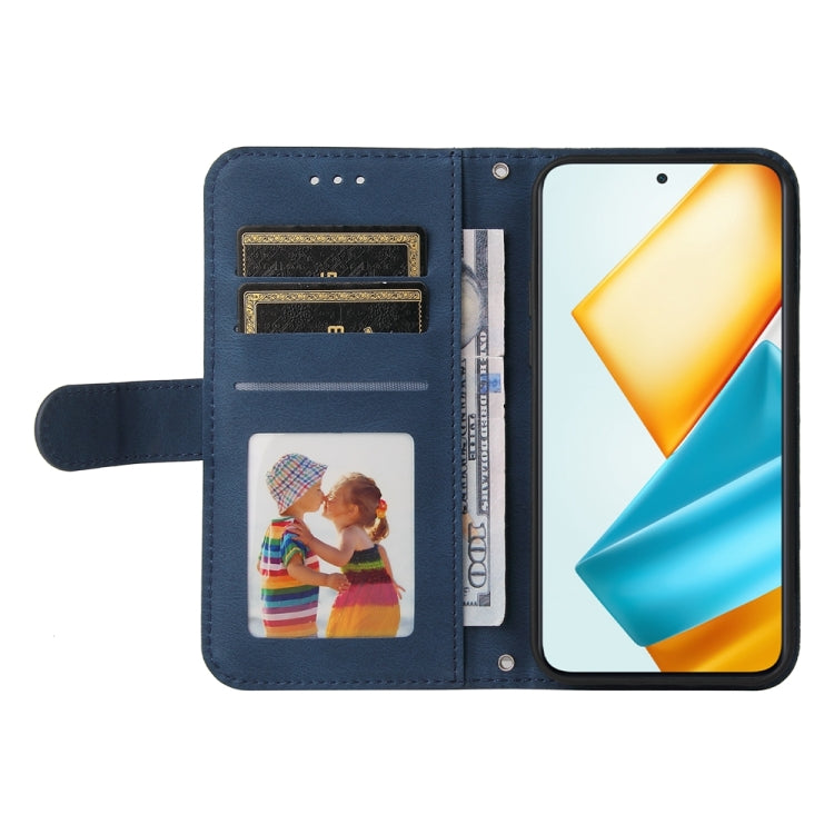 For Honor 90 GT Skin Feel Life Tree Metal Button Leather Phone Case(Blue)