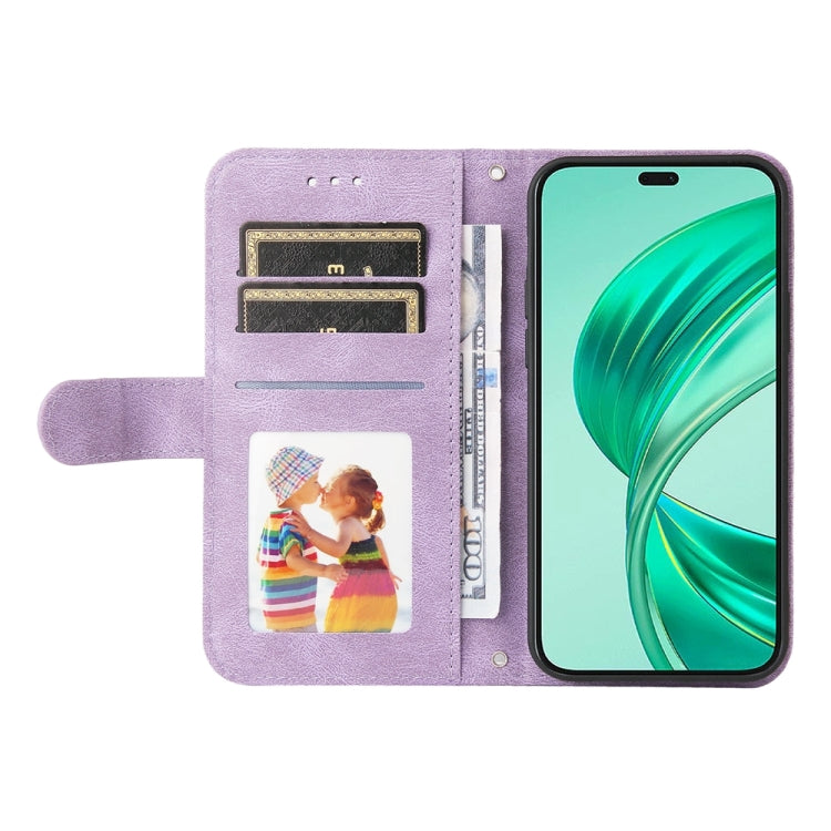 For Honor X8b Skin Feel Life Tree Metal Button Leather Phone Case(Purple)