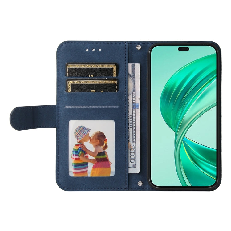 For Honor X8b Skin Feel Life Tree Metal Button Leather Phone Case(Blue)