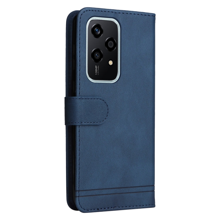 For Honor 200 Lite 5G Global Skin Feel Life Tree Metal Button Leather Phone Case(Blue)