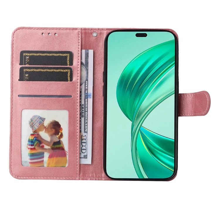 For Honor X8b Classic Calf Texture Flip Leather Phone Case(Rose Gold)