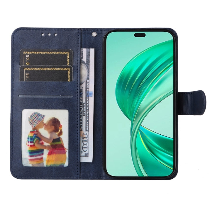 For Honor X8b Classic Calf Texture Flip Leather Phone Case(Blue)