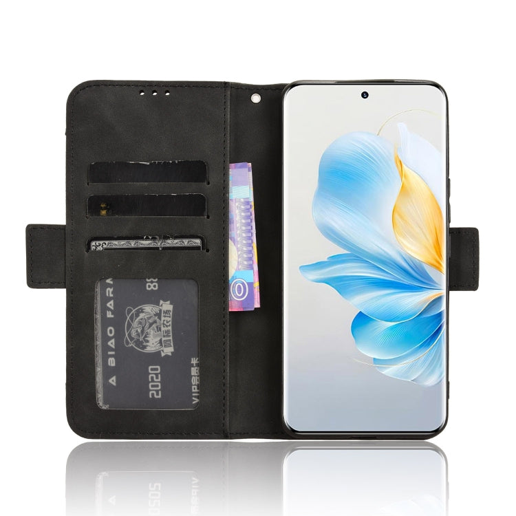 For Honor 100 5G Skin Feel Calf Texture Card Slots Leather Phone Case(Black)