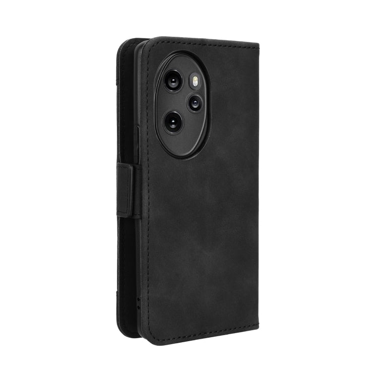 For Honor 100 Pro 5G Skin Feel Calf Texture Card Slots Leather Phone Case(Black)