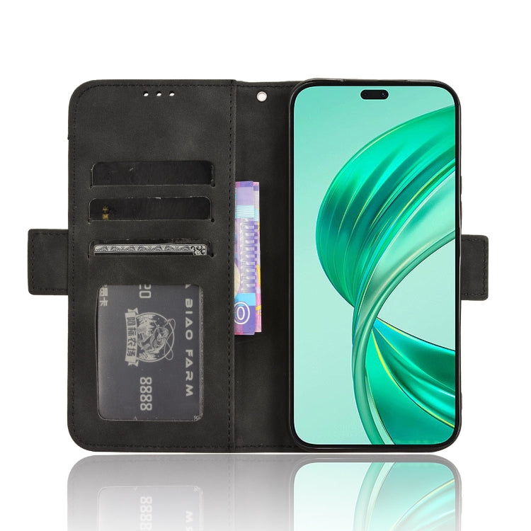 For Honor X8b 4G Skin Feel Calf Texture Card Slots Leather Phone Case(Black)