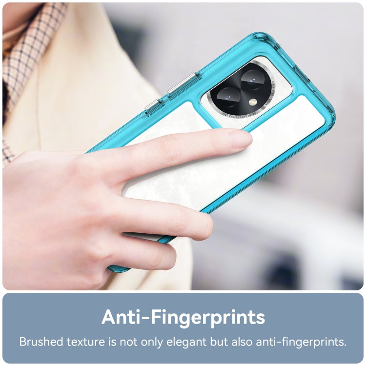 For Honor 100 Colorful Series Acrylic Hybrid TPU Phone Case(Transparent Blue)