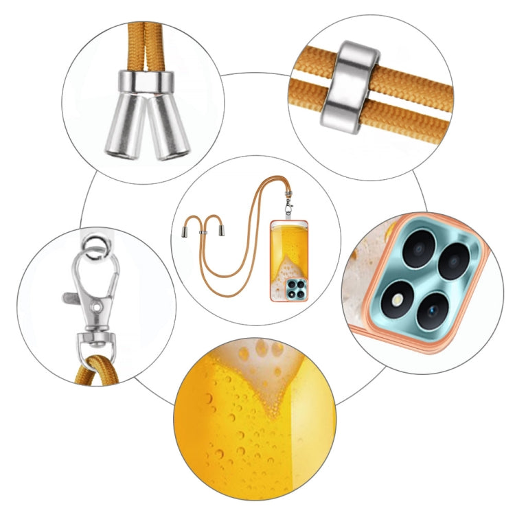 For Honor X6a Electroplating Dual-side IMD Phone Case with Lanyard(Draft Beer)