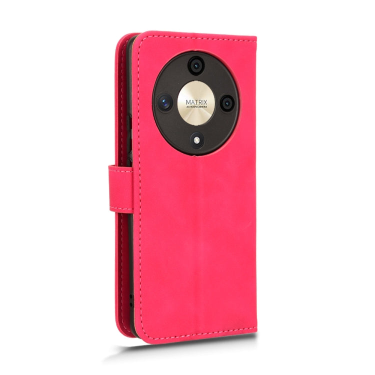 For Honor X9b Skin Feel Magnetic Flip Leather Phone Case(Rose Red)