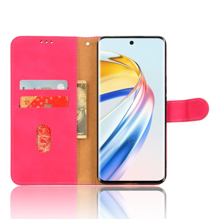 For Honor X9b Skin Feel Magnetic Flip Leather Phone Case(Rose Red)