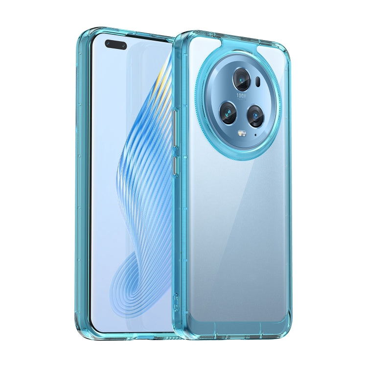 For Honor Magic5 Pro Candy Series TPU Phone Case(Transparent Blue)