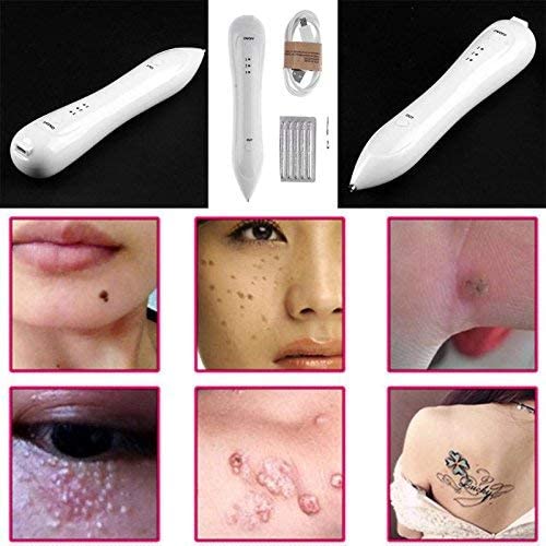 UNIQKART Skin Mole Dark Spot Remover Wart Tag Speckle Tattoo Removal Pen 3 Level Laser Plasma Pen Wart Spot Remover Mole Freckle Tattoo Removal Machine Beauty Pen Tool