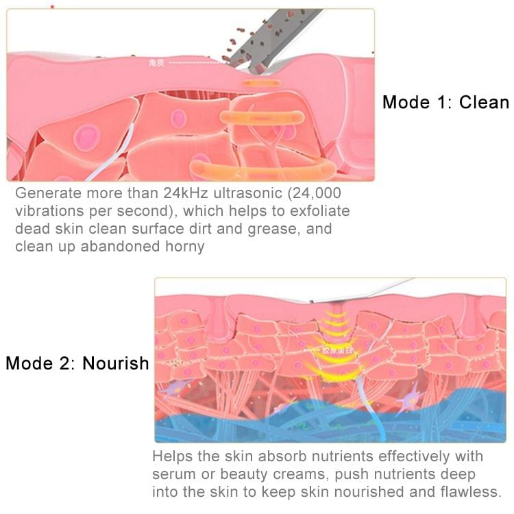 2W Ultrasonic Vibration Face Cleansing Machine Dead Skin Cleaner Scrubber Shovel Tool Face Beauty Instrument (Black)