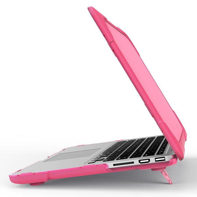 Hard PC Laptop Case Notebook Computer Cover with Supporting Stand Feet for MacBook Pro 15-inch / Pro Retina 15-inch A1398 - Rose