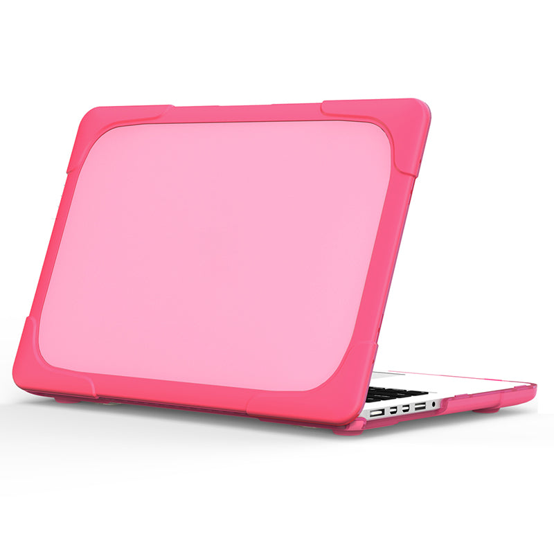 Hard PC Laptop Case Notebook Computer Cover with Supporting Stand Feet for MacBook Pro 15-inch / Pro Retina 15-inch A1398 - Rose