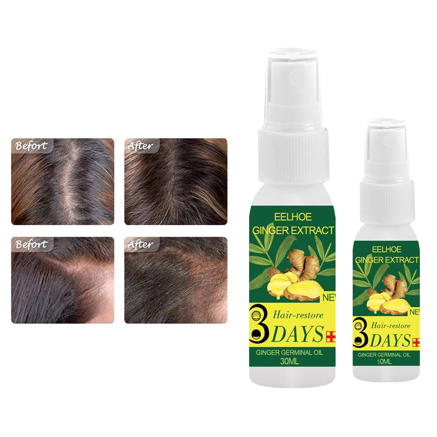 Organic Ginger Hair Growth Essential Oil Hair Care Serum Pure Natural 10ml