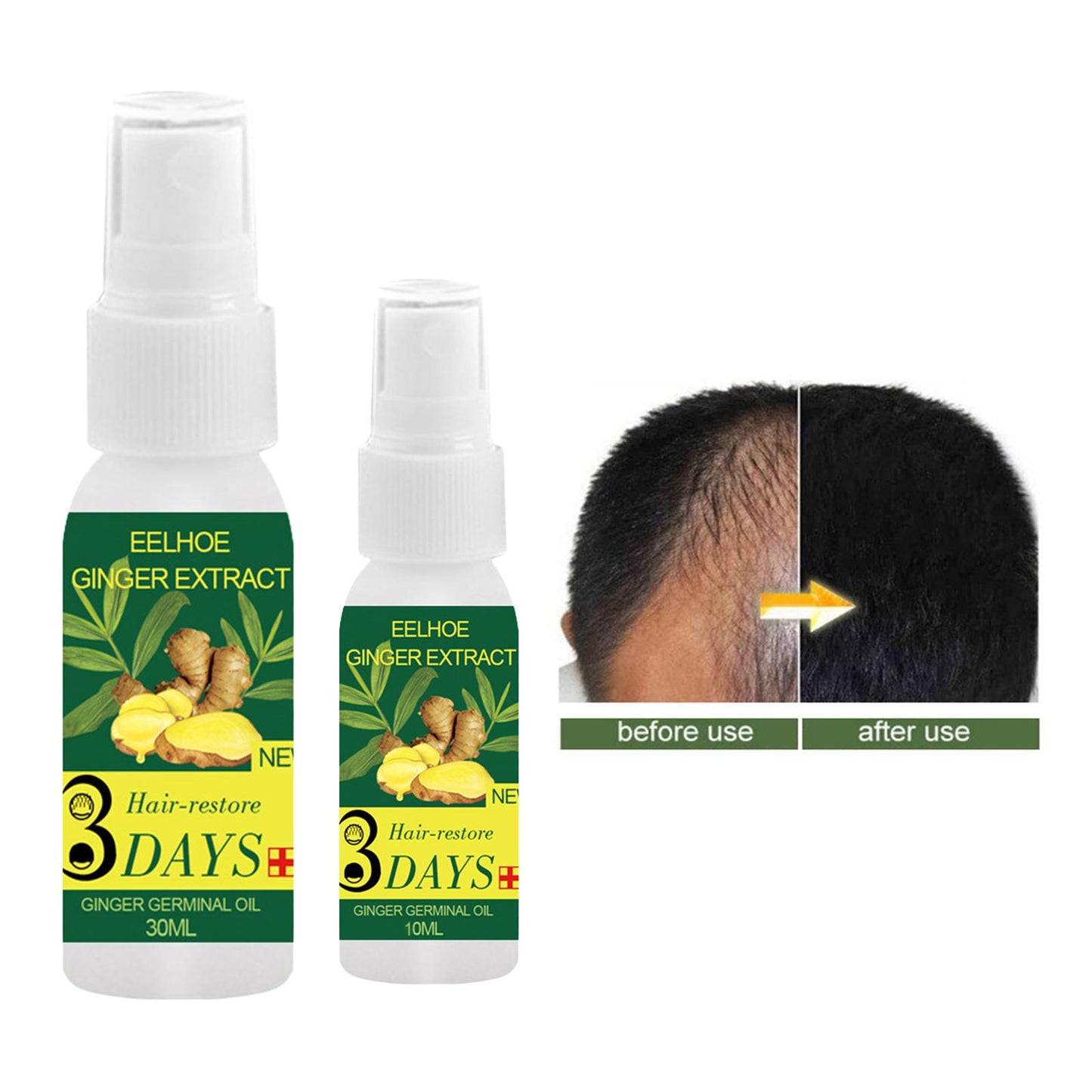 Organic Ginger Hair Growth Essential Oil Hair Care Serum Pure Natural 10ml