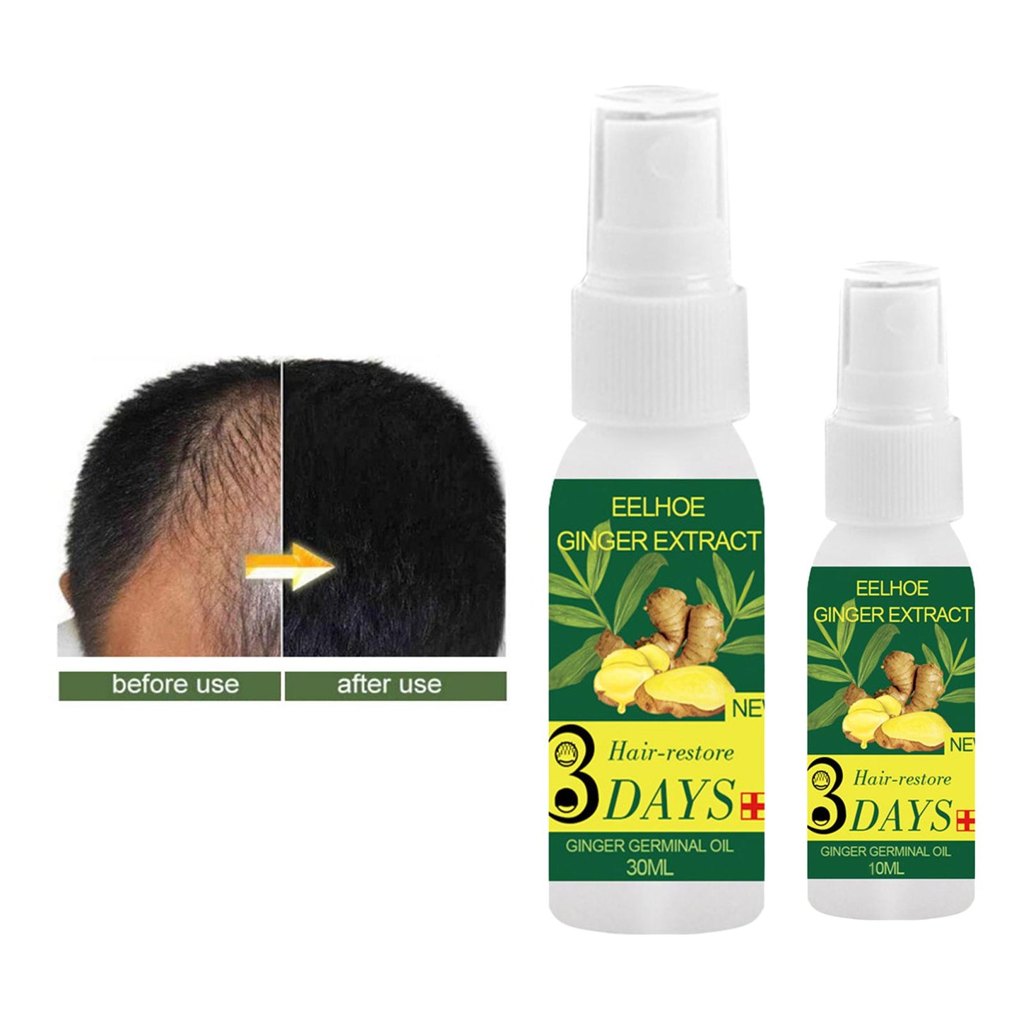 Organic Ginger Hair Growth Essential Oil Hair Care Serum Pure Natural 10ml