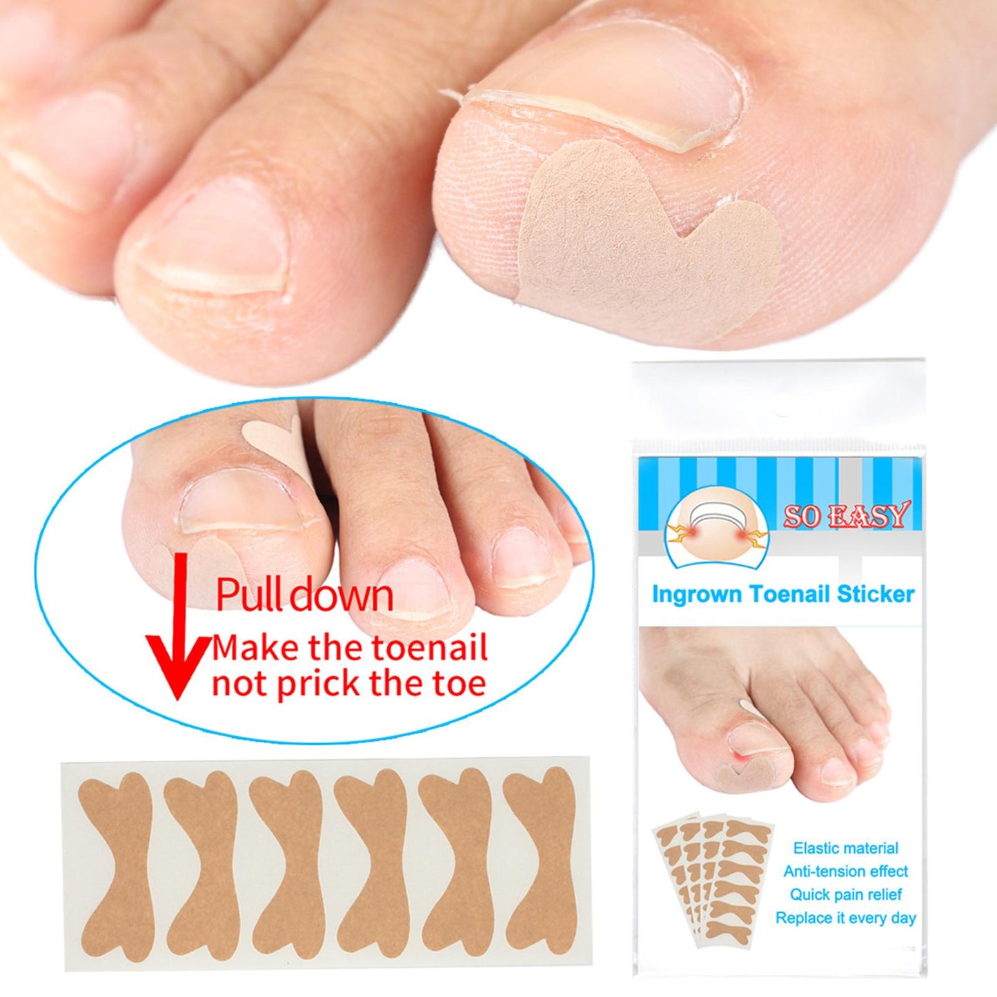 Glue Free Ingrown Toenail Stickers Corrector for Women Nail Treatment Tools 36 pcs