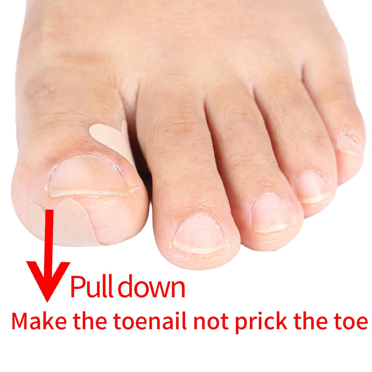 Glue Free Ingrown Toenail Stickers Corrector for Women Nail Treatment Tools 36 pcs