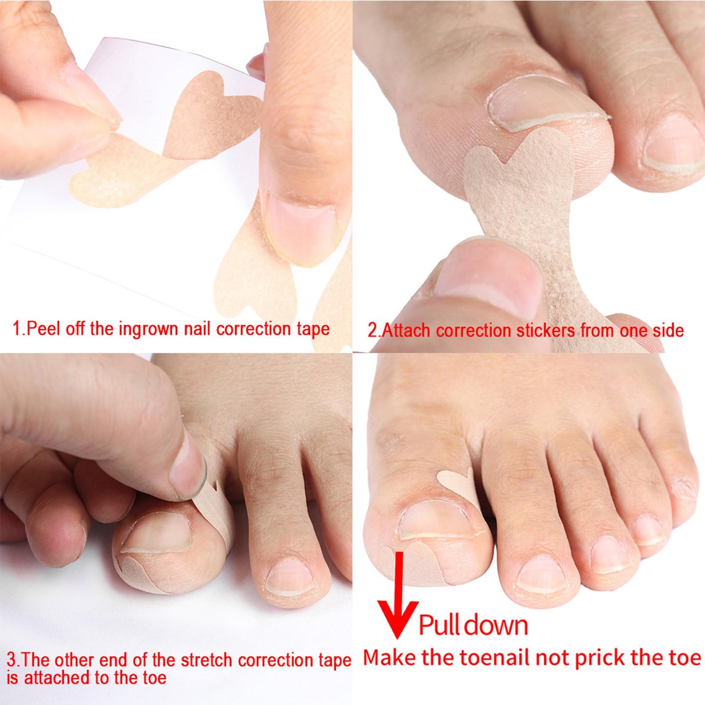 Glue Free Ingrown Toenail Stickers Corrector for Women Nail Treatment Tools 36 pcs
