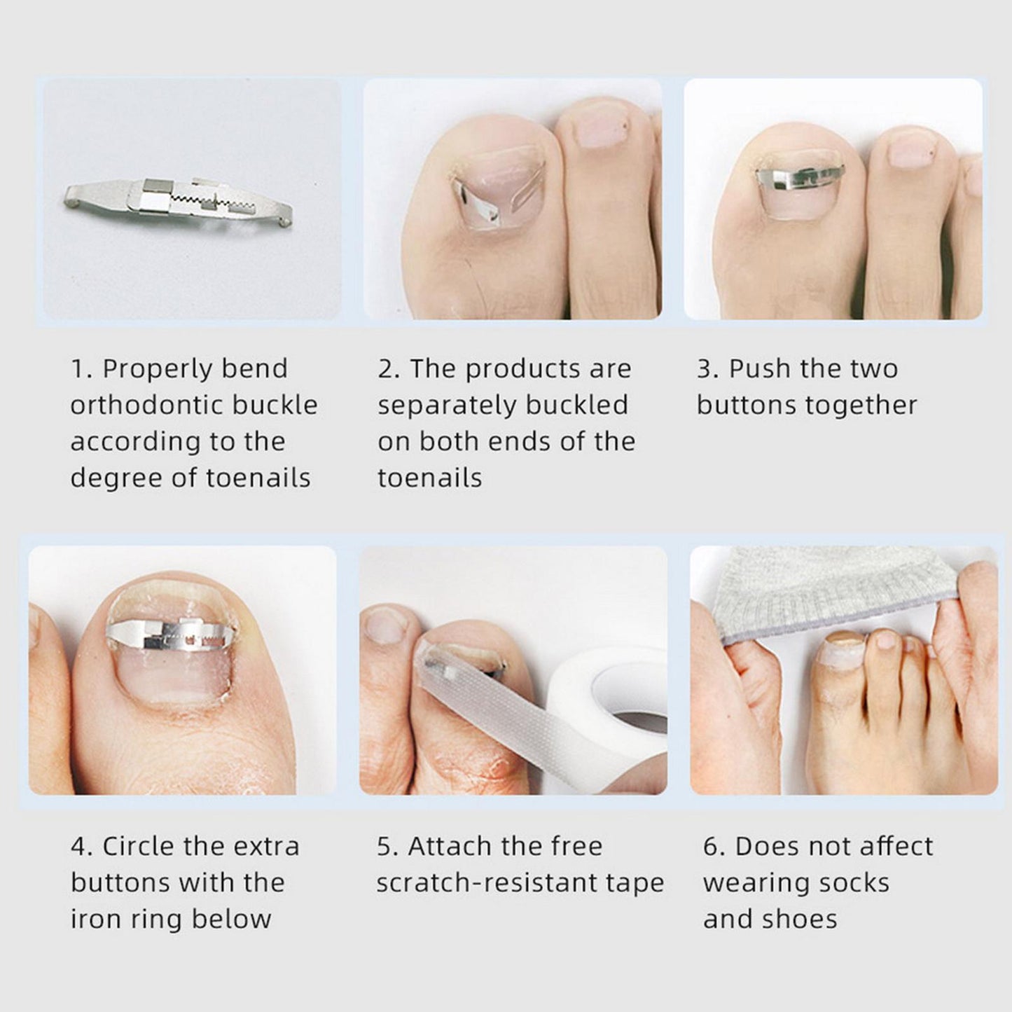 Ingrown Toenail Treatment Ingrowing Corrector Pedicure Tool Foot Care Set B