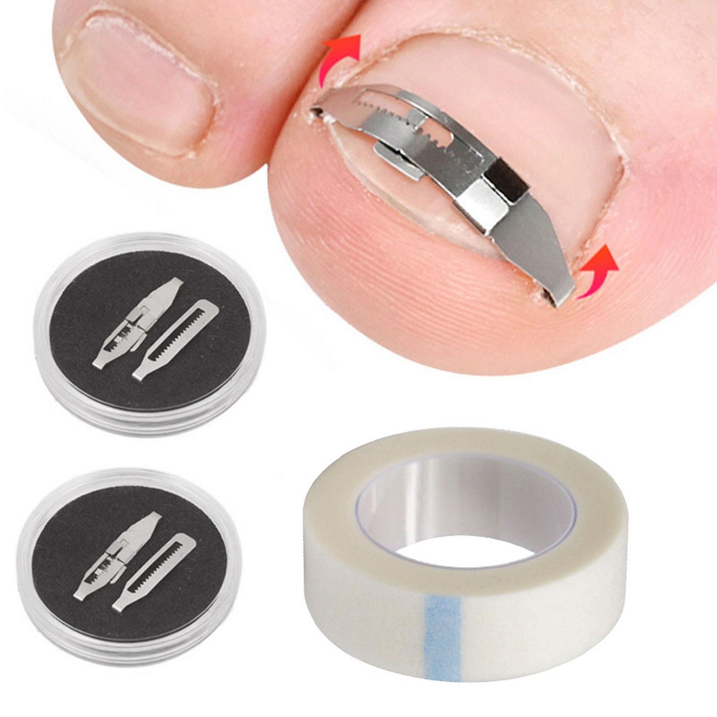 Ingrown Toenail Treatment Ingrowing Corrector Pedicure Tool Foot Care Set C