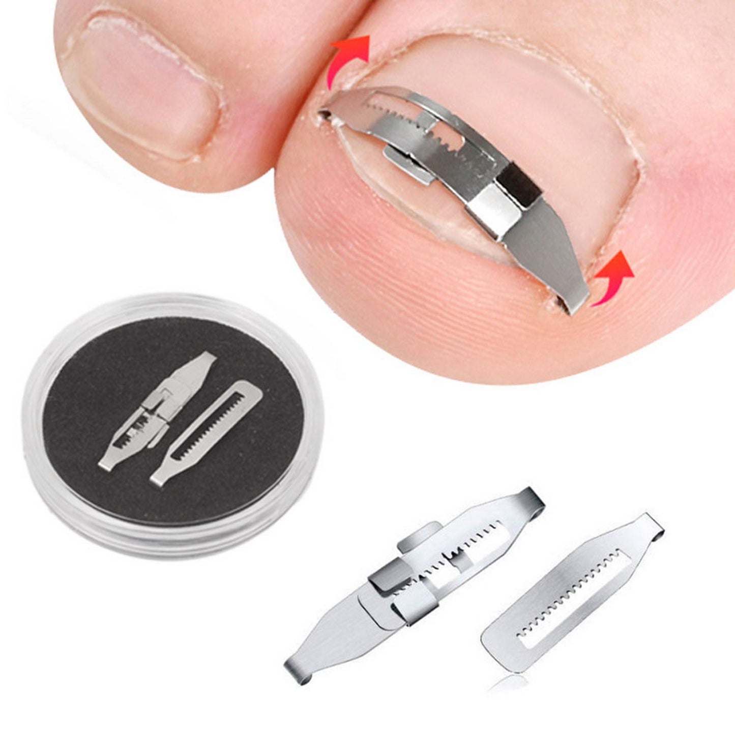 Ingrown Toenail Treatment Ingrowing Corrector Pedicure Tool Foot Care Set D
