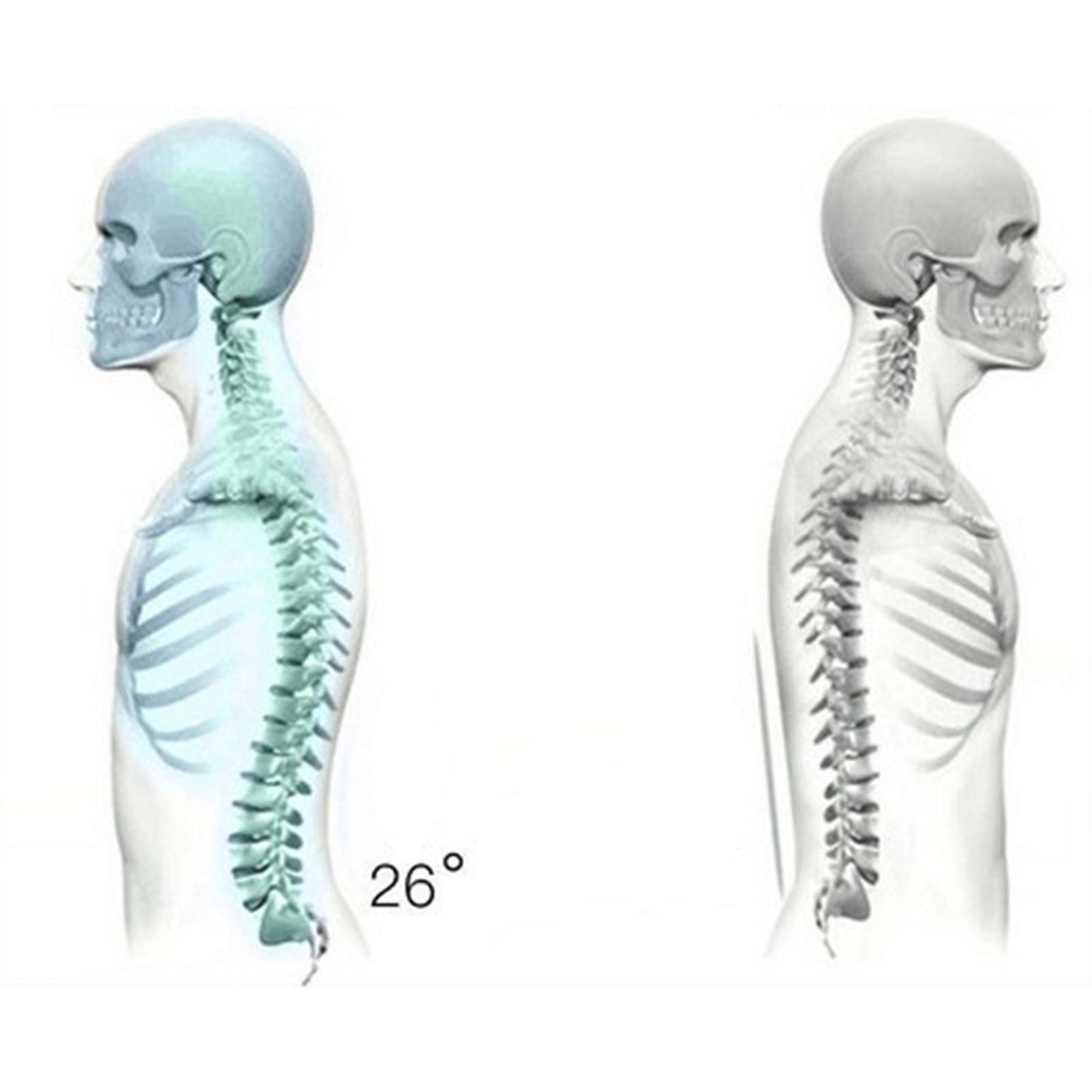 Back Stretcher Traction Deck Massager for Spine Sciatica Bed Chair Car blue