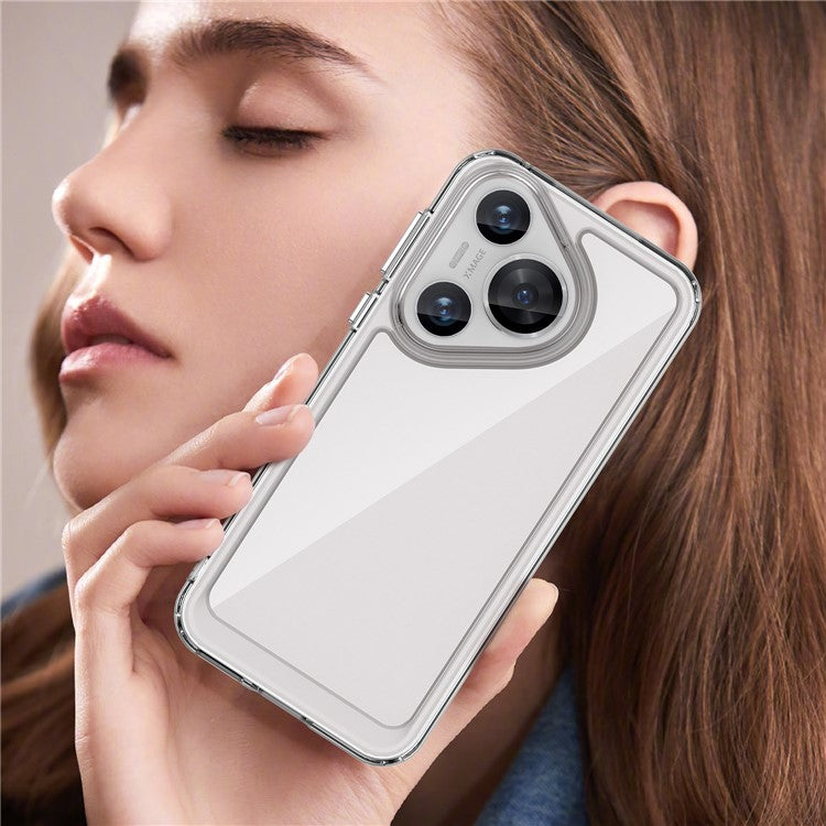 For Huawei Pura 70 Case Electroplated Buttons Ultra-Clear Phone Cover (Big Rear Lens Hole)