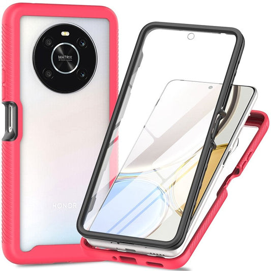For Honor X9 4G / 5G / X30 5G / Magic4 Lite 5G 3-in-1 PC + TPU Full Protection Phone Case with PET Screen Protector - Pink