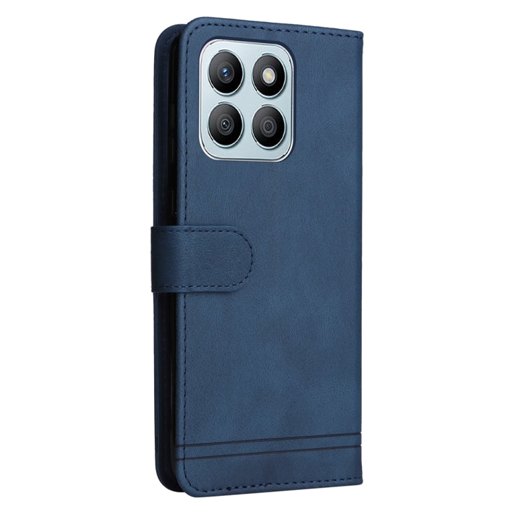 For Honor X8b Skin Feel Life Tree Metal Button Leather Phone Case(Blue)