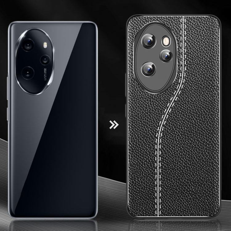 For Honor 100 Litchi Texture Shockproof TPU Phone Case(Black)