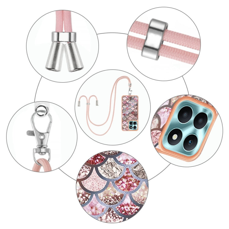 For Honor X6a Electroplating IMD TPU Phone Case with Lanyard(Pink Scales)