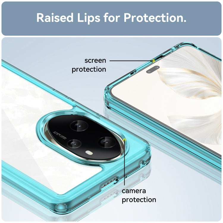For Honor 100 Pro Colorful Series Acrylic Hybrid TPU Phone Case(Transparent Blue)