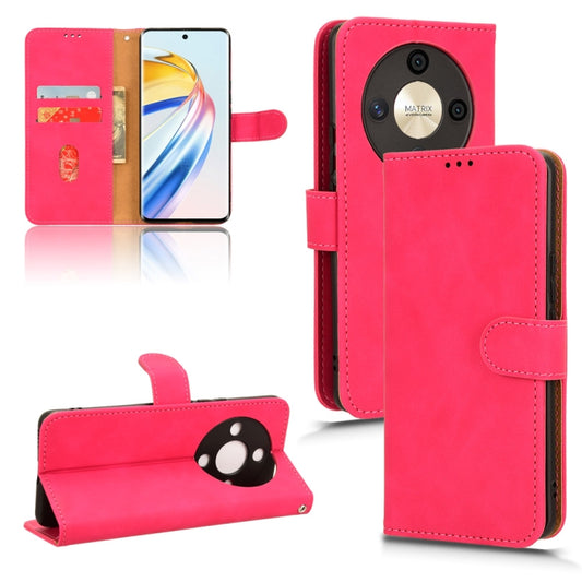 For Honor X9b Skin Feel Magnetic Flip Leather Phone Case(Rose Red)