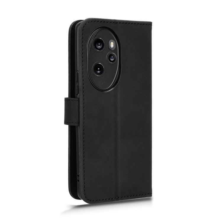 For Honor 100 Pro 5G Skin Feel Magnetic Flip Leather Phone Case(Black)