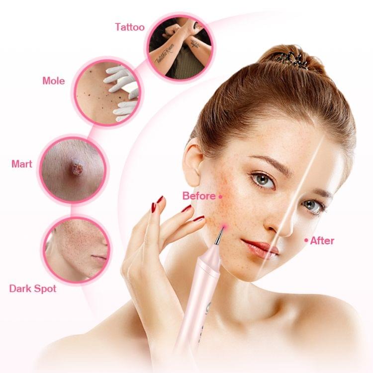 K-SKIN KD306 Laser Spotting Machine Plasma Pen Dark Eyelash Remover for Facial Spasm Removal Tattoo Skin Care(White)