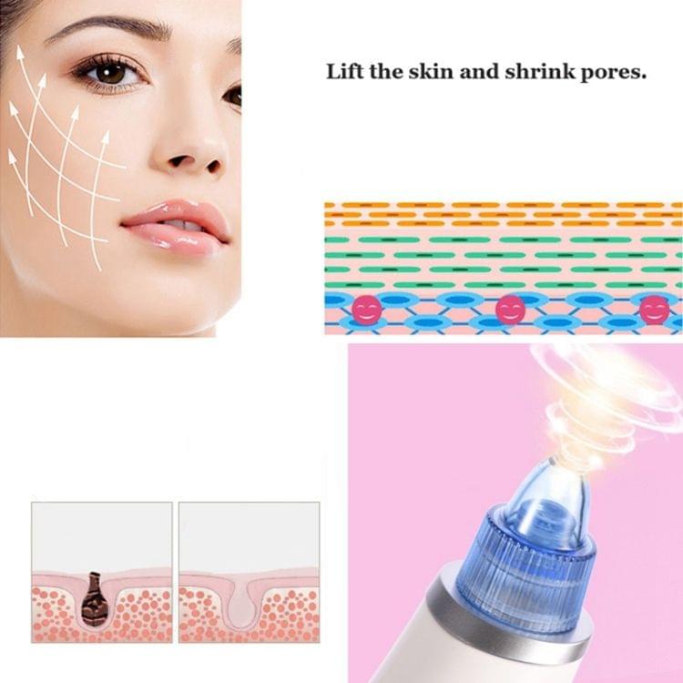 5W 1A Multi-function Blackhead Extractor Pore Cleanser with Four Probes(Pink)