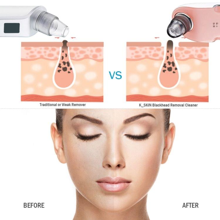 K-SKIN KD803A 3 Level Intensity Blackhead Removal Pore Cleaner Suction Rechargeable Black Spot Cleaner Facial Cleaning Machine