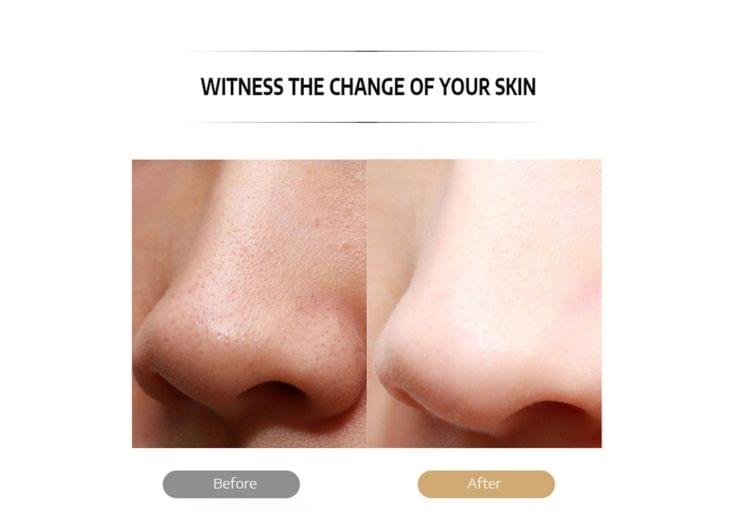 K-SKIN KD-8023Ultrasonic Blackhead Acne Removal Pore Cleaner Facial Skin Care Scrubber Exfoliating Pore Cleaner