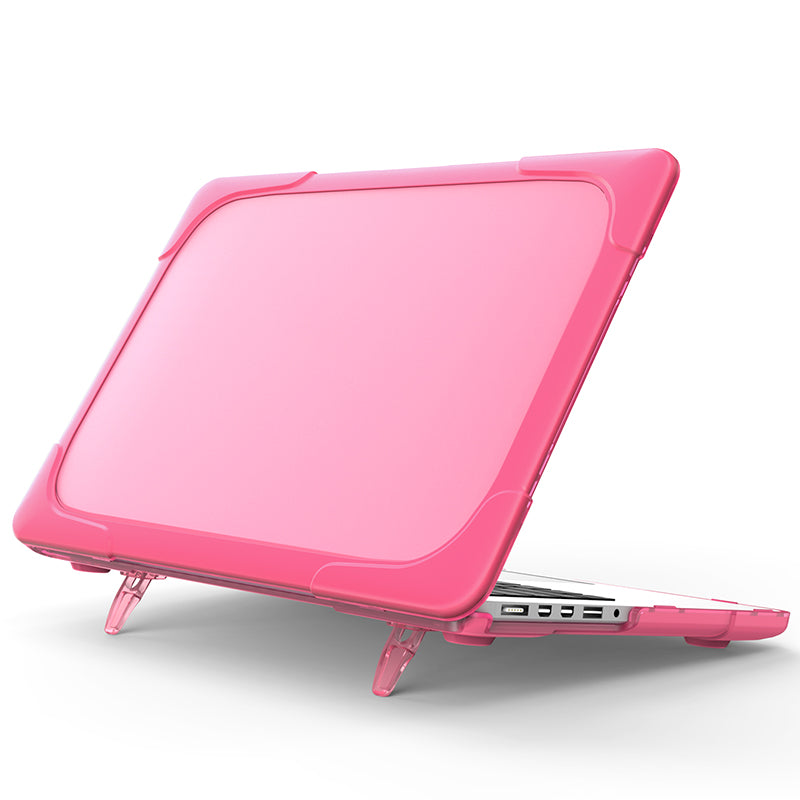 Hard PC Laptop Case Notebook Computer Cover with Supporting Stand Feet for MacBook Pro 15-inch / Pro Retina 15-inch A1398 - Rose