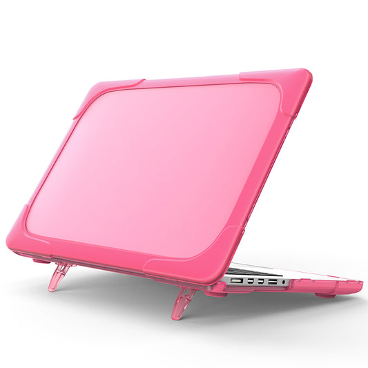 Hard PC Laptop Case Notebook Computer Cover with Supporting Stand Feet for MacBook Pro 15-inch / Pro Retina 15-inch A1398 - Rose