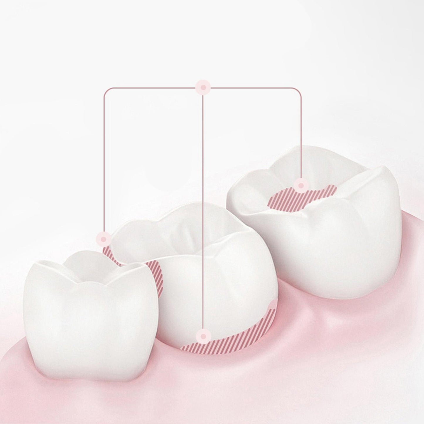 Water Flosser Teeth Cleaner for Travel Home Braces Braces Bridges Care pink