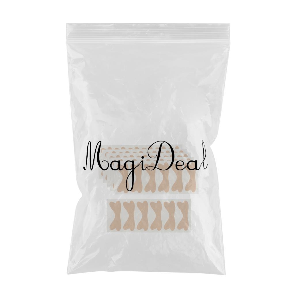 Glue Free Ingrown Toenail Stickers Corrector for Women Nail Treatment Tools 36 pcs