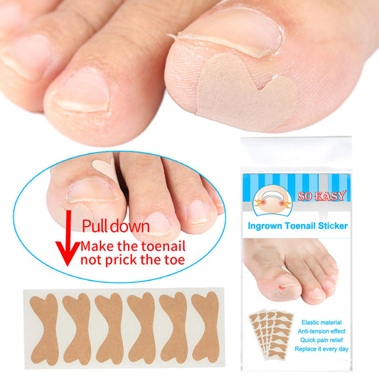 Glue Free Ingrown Toenail Stickers Corrector for Women Nail Treatment Tools 60 pcs