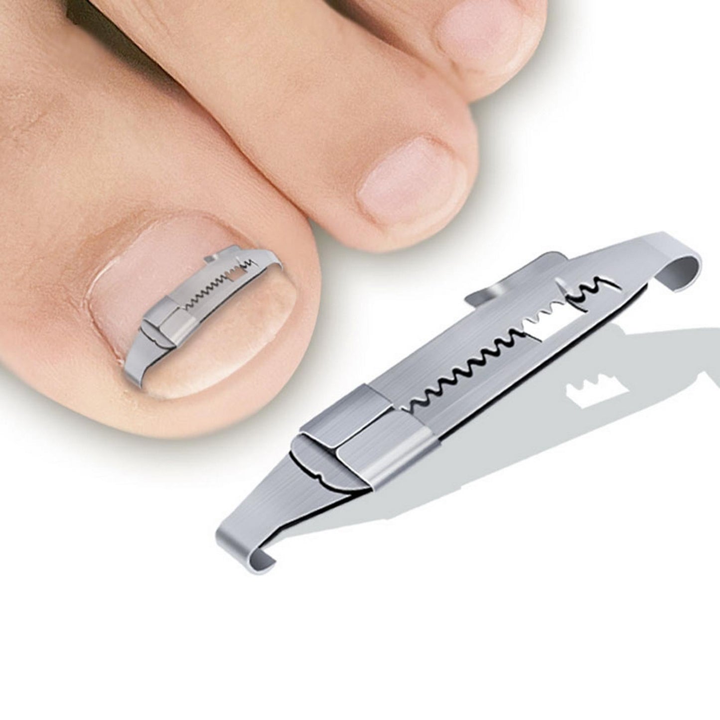 Ingrown Toenail Treatment Ingrowing Corrector Pedicure Tool Foot Care Set C