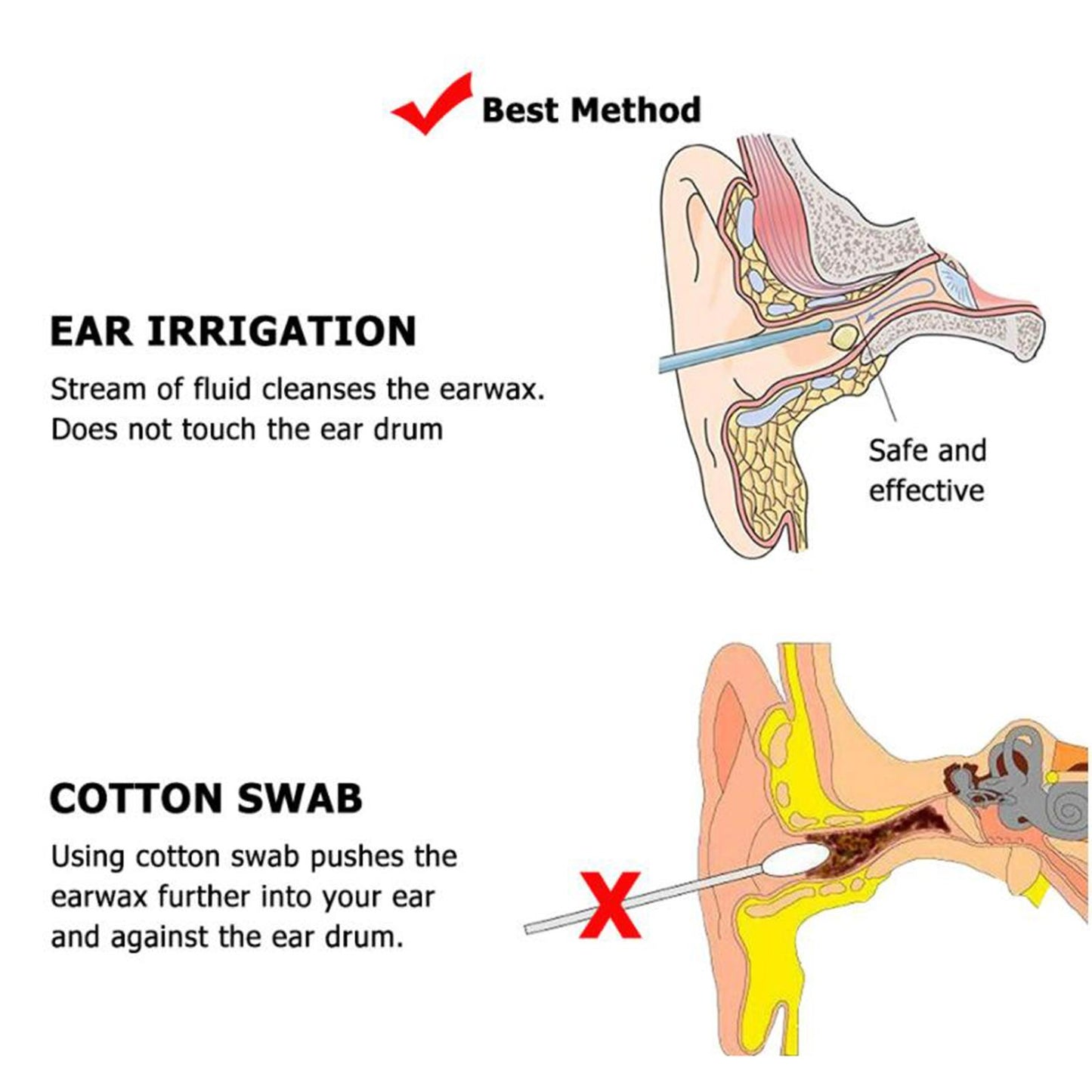 Earwax Removal Set Ear Wax Washer Cleaner Tool Effective All In One