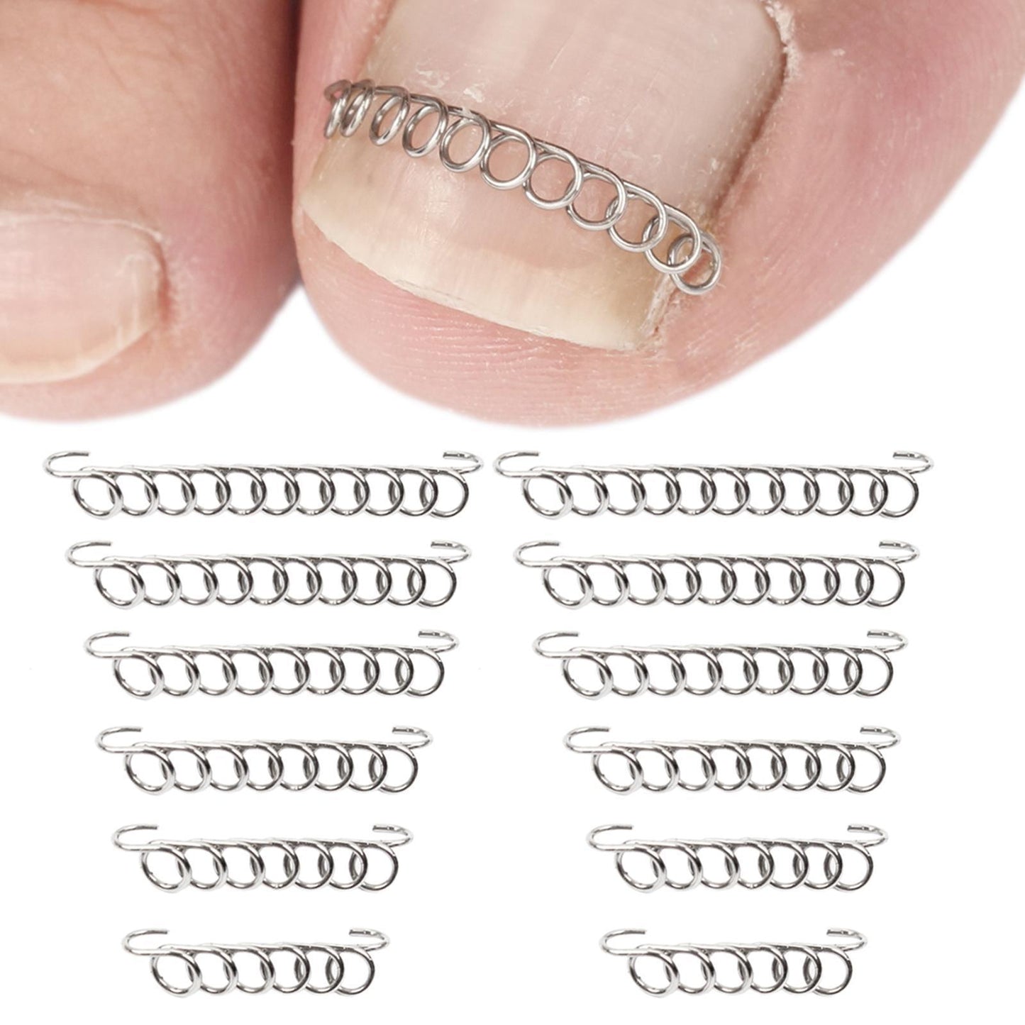 Ingrown Toenail Correction Nail Lifter Clamp File Toe Treatment Tool kit